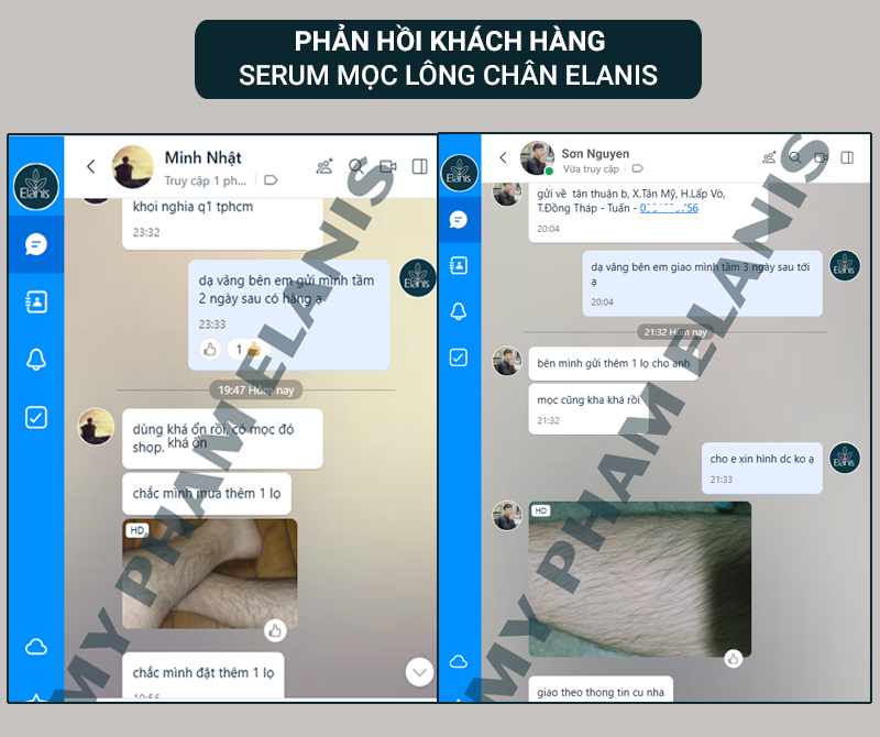 phản hồi thuốc mọc lông chân