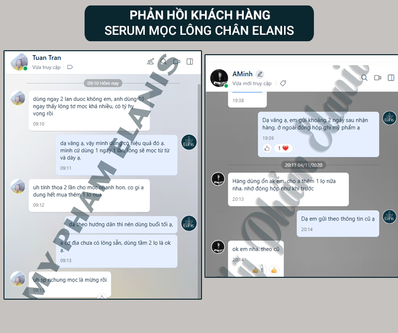 review thuốc mọc lông chân