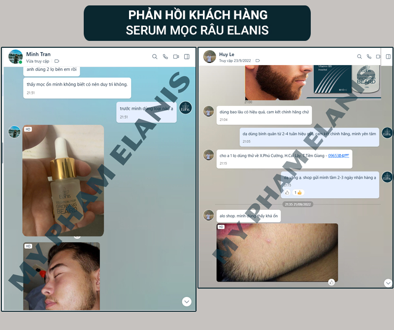 review thuốc mọc râu elanis