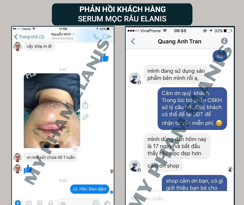 phản hồi thuốc mọc râu elanis