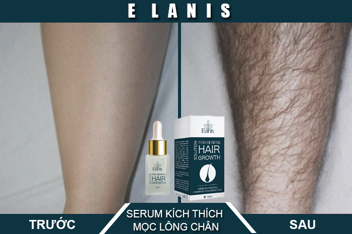 thuốc mọc lông chân elanis