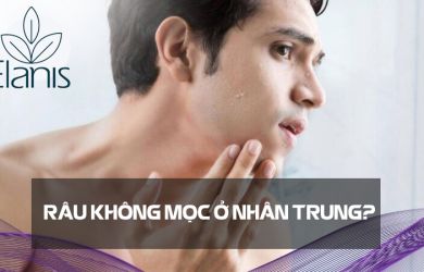 Râu Không Mọc Ở Nhân Trung - Cách Khắc Phục Hiệu Quả