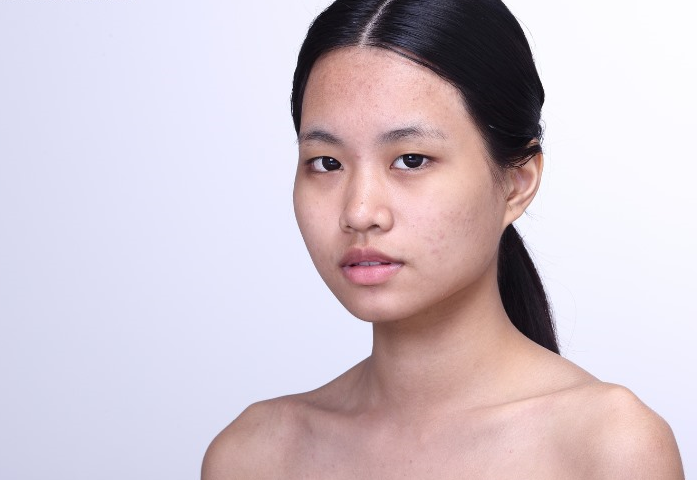 đuôi lông mày thưa nhạt