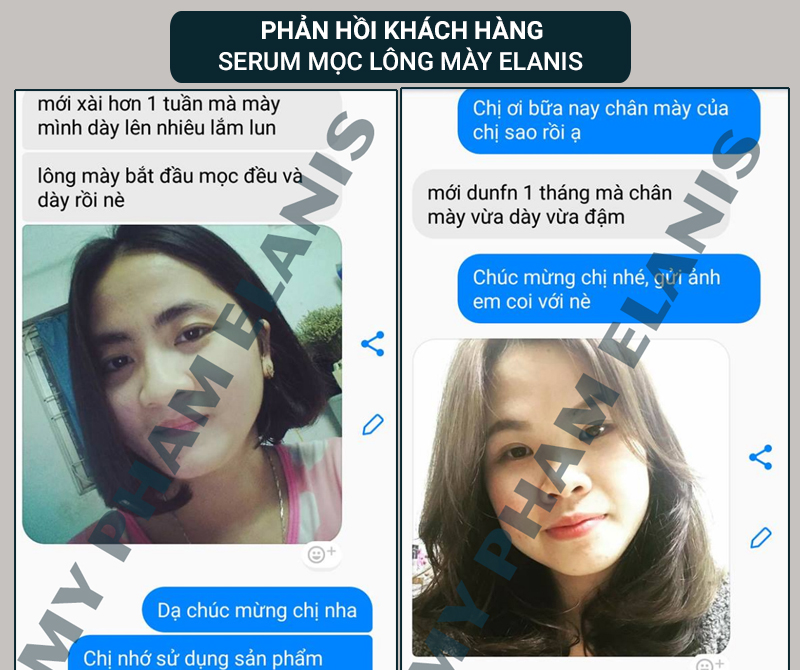 review thuốc mọc lông mày