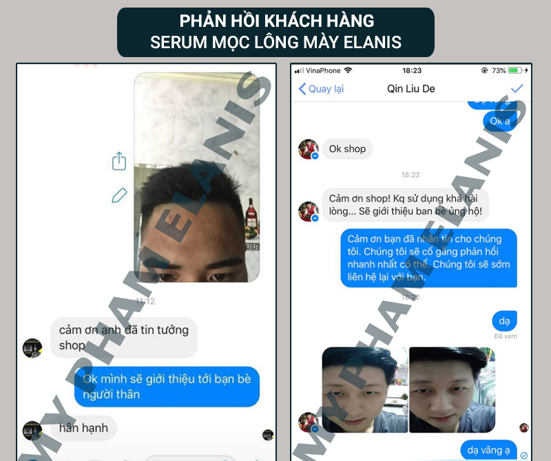 phản hồi thuốc mọc lông mày elanis