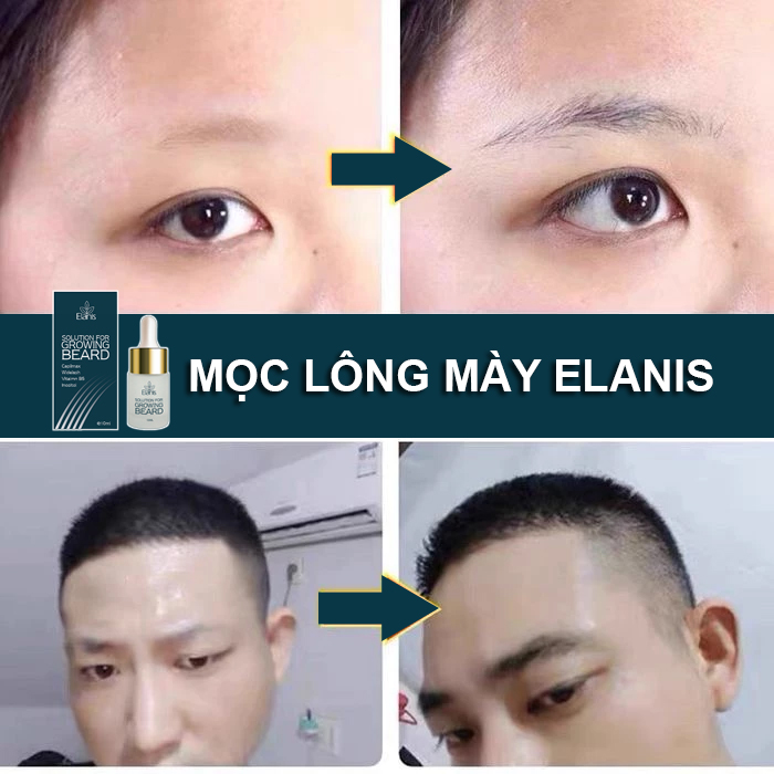 thuốc mọc lông mày elanis