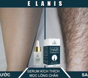 Kích Thích Mọc Lông Chân Cho Nam